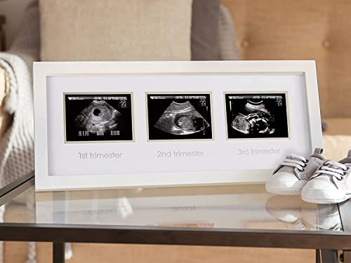 מסגרת תמונה משולשת של ראש אגס, מסגרת תמונה למזכרת הריון, משתלת תינוקות ניטרלית מגדרית