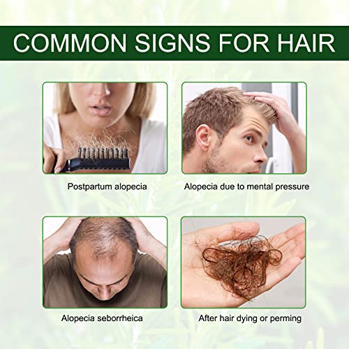 שמן רוזמרין לצמיחת שיער 2 פל אונקיה, סרום שמנים אתריים רוזמרין אורגני טהור לשיער וצמיחה פגומים