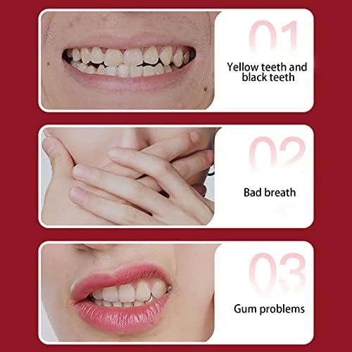 גוון המבהיר משחת שיניים עד כתמים צהובים שיניים לבנות נקי פה משחת שיניים טרי כתמי שיניים צהובות