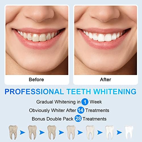 56 רצועות רצועות הלבנת שיניים - 28 טיפולים ערכת הלבנת שיניים לשיניים רצועות לבנות רגישות לשיניים הלבנת