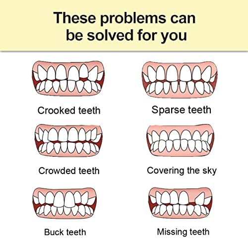 שיניים מזויפות מיידיות, פורניר שיניים לתיקון שיקום שיניים זמני, שקע פורניר לסת עליון ותחתון, ערכות תיקון