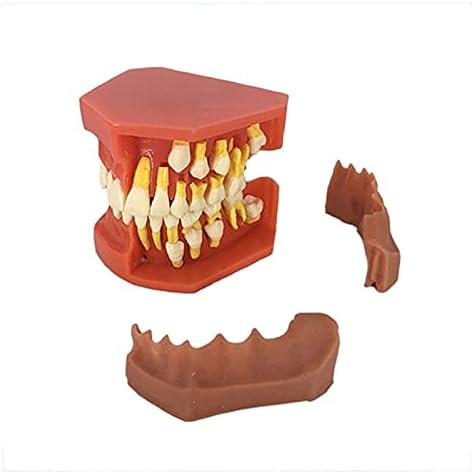 מודל איברים אנושיים LMEILI מודל שיניים, מודל שיניים סטנדרטי, מודל השיניים הנשיר של ילדים, מודל שיניים לתקשורת