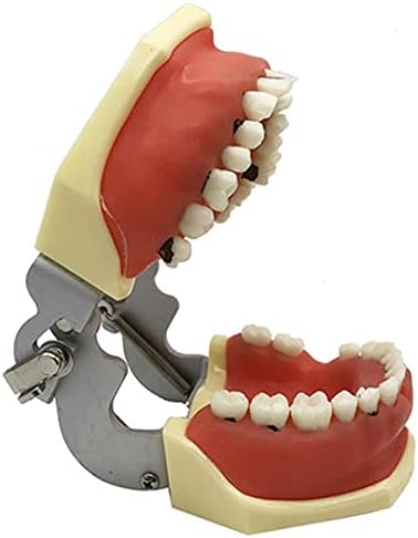 מודל פתולוגיה חניכיים של kh66zky - מודל שיניים - מחקר שיניים שקוף למחלות למבוגרים מודל שיניים להוראה