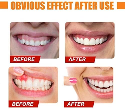 הסר כתמי פלאק מטפלים במשחת שיניים נושמים בפה רגיש K0G9 שיניים מטהר שיניים משחת שיניים הלבנה